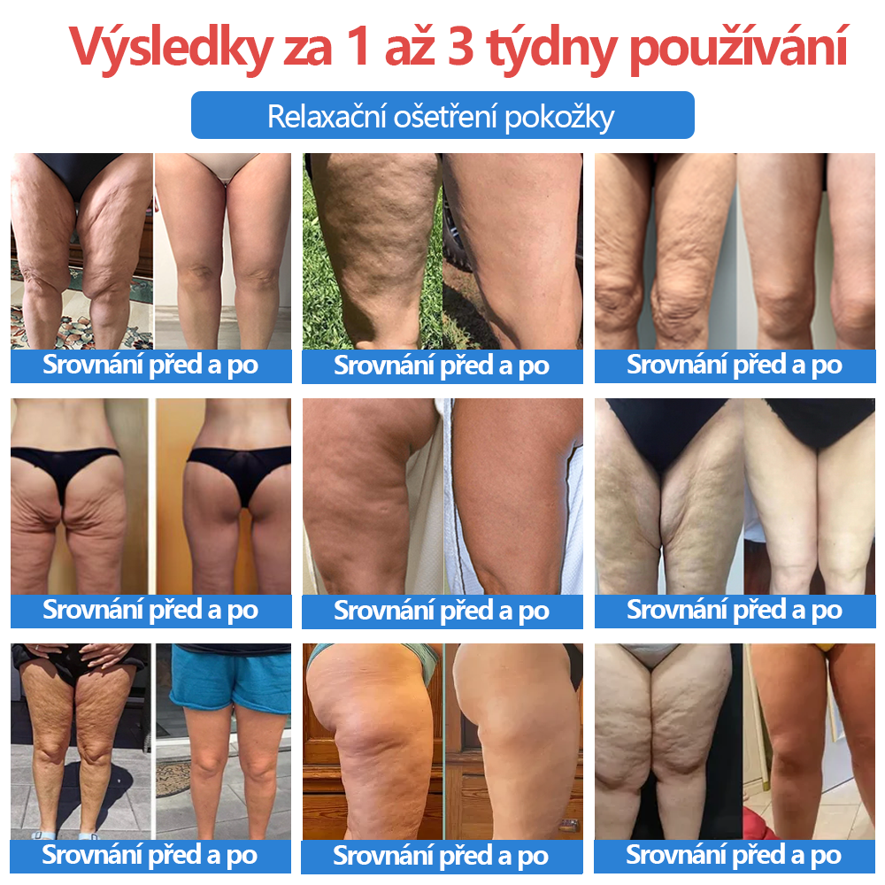 Samozahřívací turmalínové šortky III z titanového vlákna – vytvarujte si své vysněné tělo!