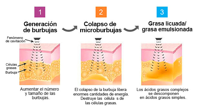 【💎Tienda insignia oficial💎】𝐆𝐅𝐎𝐔𝐊™ Muñequera ultrasónica para eliminar grasa y desintoxicar - Energy Balance 🎁 (Descuento por tiempo limitado + Recomendado por un médico)