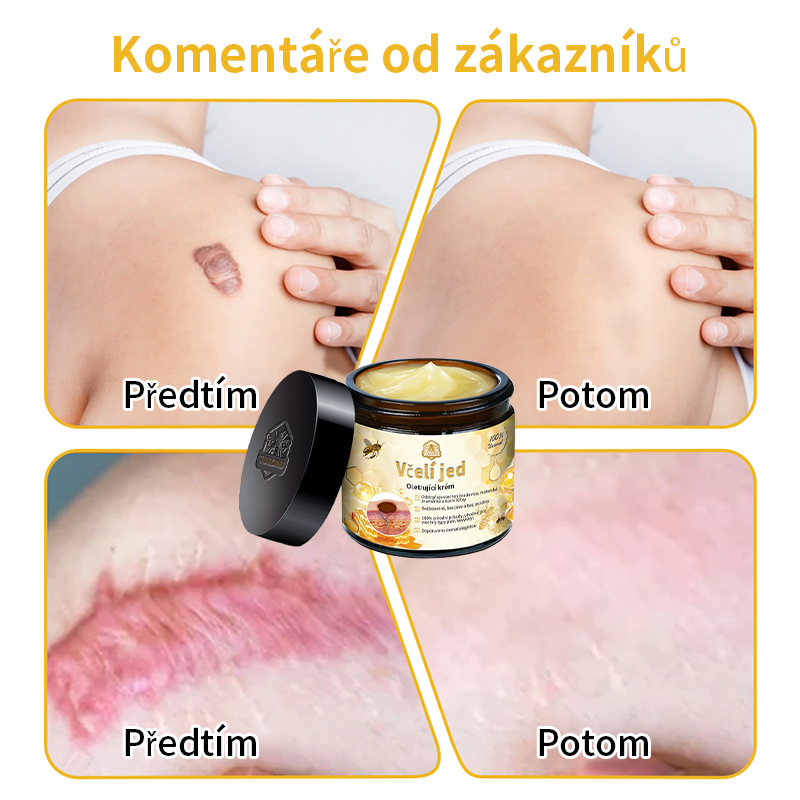 🔆🔆𝐓𝐮𝐫𝐨𝐧𝐮™🌿 krém na obnovu pleti s včelím jedem(✅CADV doporučuje) (🔥výprodej poslední den, 80% sleva)🎁