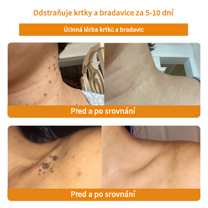 🔆🔆𝐓𝐮𝐫𝐨𝐧𝐮™🌿 krém na obnovu pleti s včelím jedem(✅CADV doporučuje) (🔥výprodej poslední den, 80% sleva)🎁