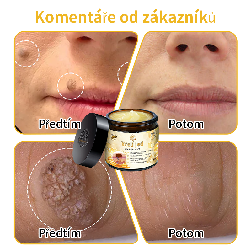 🔆🔆𝐓𝐮𝐫𝐨𝐧𝐮™🌿 krém na obnovu pleti s včelím jedem(✅CADV doporučuje) (🔥výprodej poslední den, 80% sleva)🎁