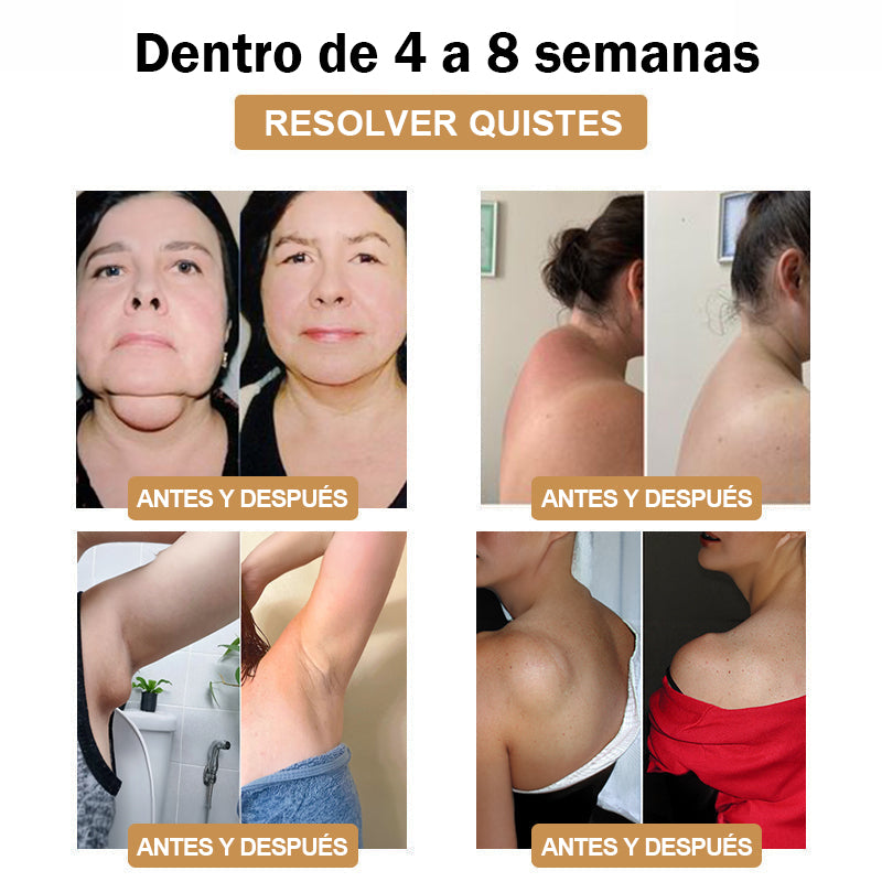 【💎Tienda insignia oficial💎】𝐆𝐅𝐎𝐔𝐊™ Muñequera ultrasónica para eliminar grasa y desintoxicar - Energy Balance 🎁 (Descuento por tiempo limitado + Recomendado por un médico)