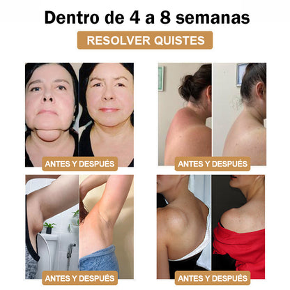 【💎Tienda insignia oficial💎】𝐆𝐅𝐎𝐔𝐊™ Muñequera ultrasónica para eliminar grasa y desintoxicar - Energy Balance 🎁 (Descuento por tiempo limitado + Recomendado por un médico)